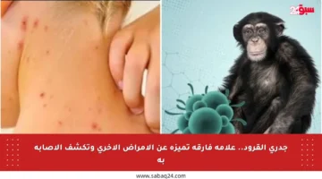 جدري القرود.. علامة فارقة تميزه عن الأمراض الأخرى وتكشف الإصابة به